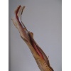 Arteria brachialis
